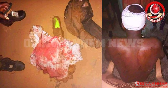 Breaking: Catholic Priest attacked by herdsmen in Enugu