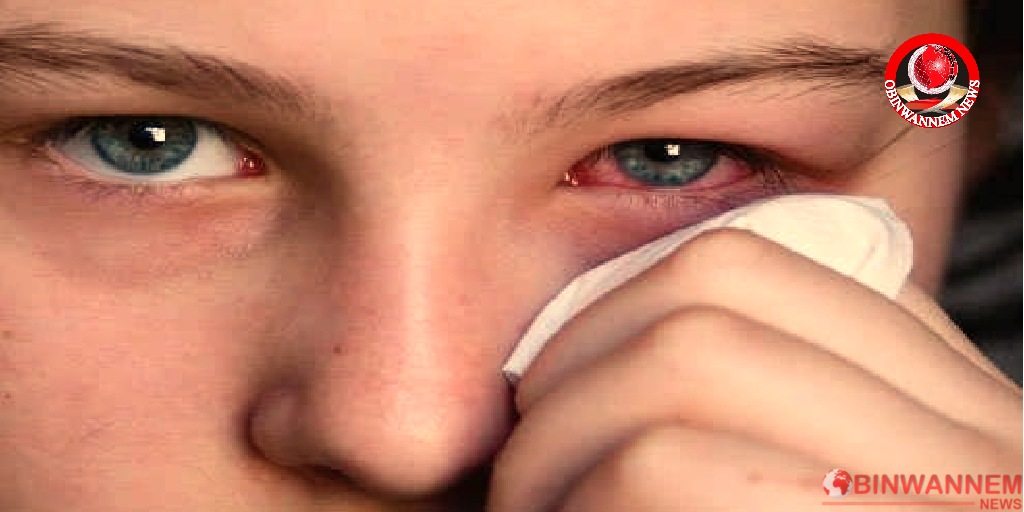 APOLLO: Signs And Symptoms Which Shows That You Are Developing Conjunctivitis