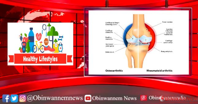 Health: Causes and treatment of Arthritis